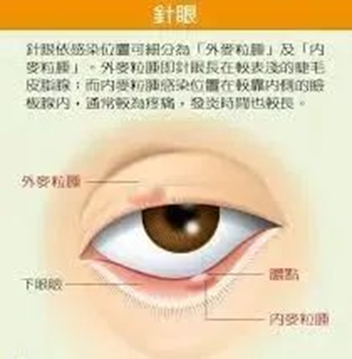 圖片 2.png